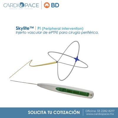 CANASTILLA SKYLITE